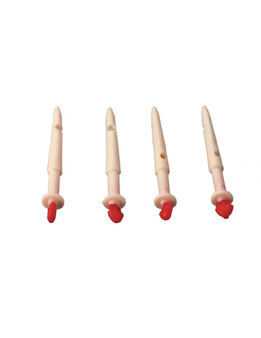 Καθετήρας θηλής μαστού